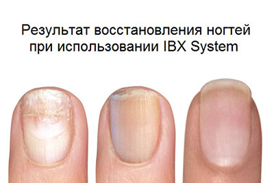 Система восстановления ногтей Famous Names IBX System фото 3 Система восстановления ногтей Famous Names IBX System фото 3